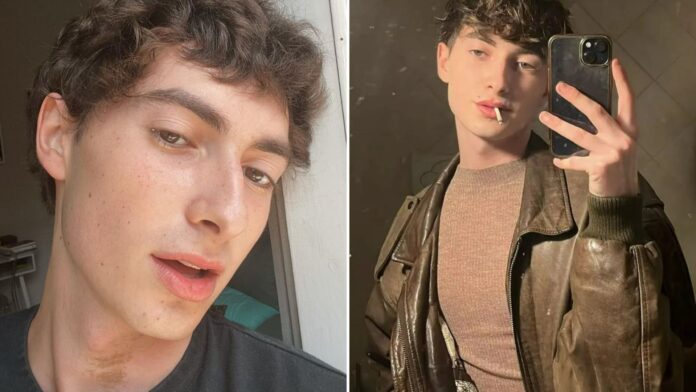 Bernardo Marziani dead at 20: Young Italian model dies after heartbreaking battle with bone cancer