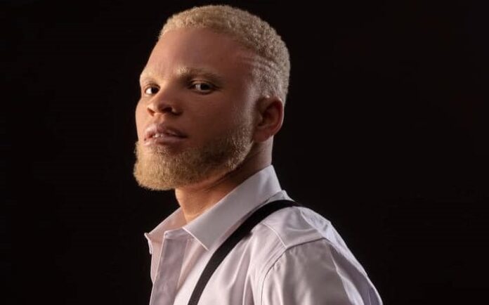 I was rejected by record labels due to my albinism, 
I was rejected by record labels due to my albinism, poor eyesight – Byno Ayoni